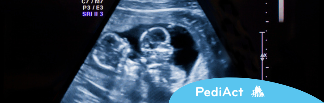 Enceinte de jumeaux : tout savoir
