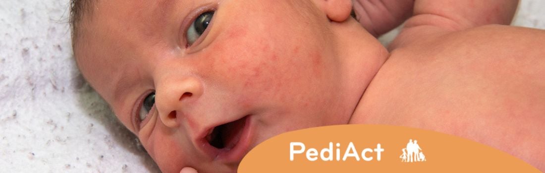 Comment calmer la peau atopique de mon bébé ?